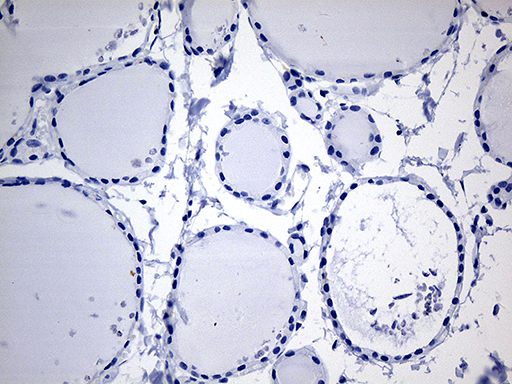 Immunohistochemical staining of paraffin-embedded Human thyroid tissue within the normal limits using anti-CYTH4 mouse monoclonal antibody