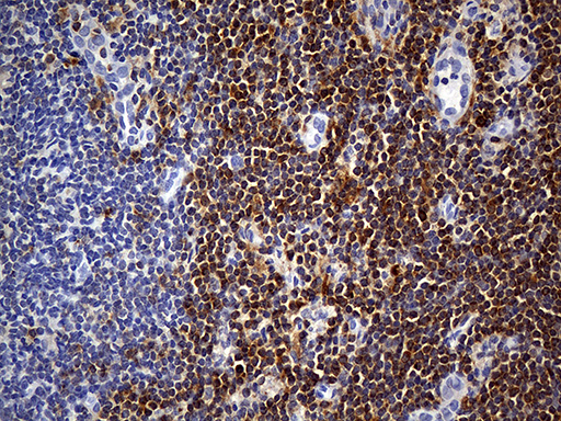 m13279 anti pscd4 cyth4 mouse monoclonal antibody clone id oti4a5 ihc testing 4