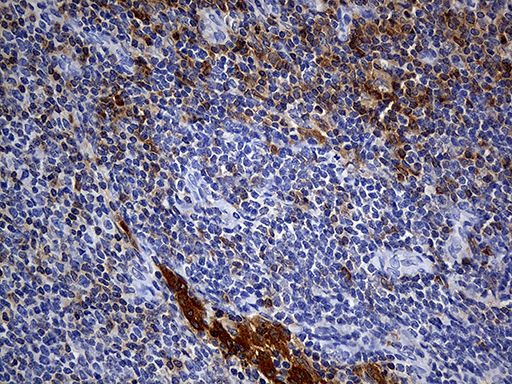 m13279 anti pscd4 cyth4 mouse monoclonal antibody clone id oti4a5 ihc testing 5