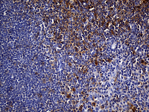 m13279 anti pscd4 cyth4 mouse monoclonal antibody clone id oti4a5 ihc testing 6