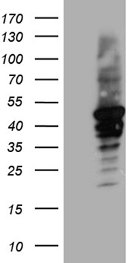 HEK293T cells were transfected with the pCMV6-ENTRY control (Left lane) or pCMV6-ENTRY CYTH4 (Right lane) cDNA for 48 hrs and lysed