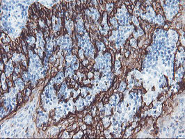 m13302 anti srpr beta srprb mouse monoclonal antibody clone id oti1d9 ihc testing 10