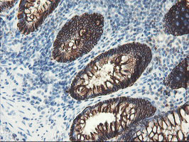 m13302 anti srpr beta srprb mouse monoclonal antibody clone id oti1d9 ihc testing 11