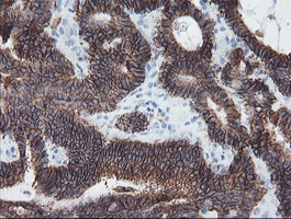 m13302 anti srpr beta srprb mouse monoclonal antibody clone id oti1d9 ihc testing 12