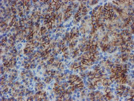 m13302 anti srpr beta srprb mouse monoclonal antibody clone id oti1d9 ihc testing 4