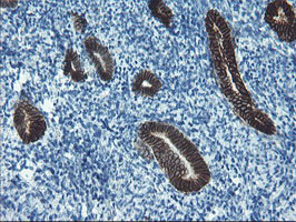m13302 anti srpr beta srprb mouse monoclonal antibody clone id oti1d9 ihc testing 5