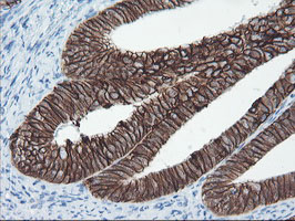 m13302 anti srpr beta srprb mouse monoclonal antibody clone id oti1d9 ihc testing 6