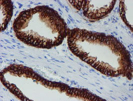 m13302 anti srpr beta srprb mouse monoclonal antibody clone id oti1d9 ihc testing 7