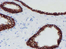 m13302 anti srpr beta srprb mouse monoclonal antibody clone id oti1d9 ihc testing 8