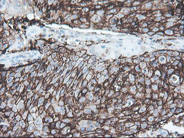 m13302 anti srpr beta srprb mouse monoclonal antibody clone id oti1d9 ihc testing 9