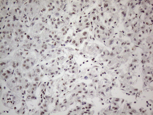 m13346 anti sdccag10 cwc27 mouse monoclonal antibody clone id oti4c8 ihc testing 11