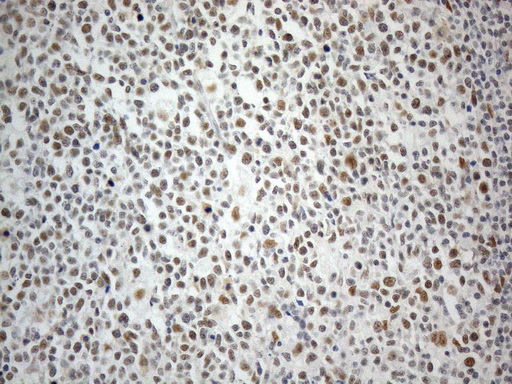 Immunohistochemical staining of paraffin-embedded Human tonsil within the normal limits using anti-CWC27 mouse monoclonal antibody. (Heat-induced epitope retrieval by 1mM EDTA in 10mM Tris buffer (pH8.5) at 120°C for 3min Immunohistochemical staining of paraffin-embedded Human tonsil within the normal limits using anti-CWC27 mouse monoclonal antibody. (Heat-induced epitope retrieval by 1mM EDTA in 10mM Tris buffer (pH8.5) at 120°C for 3min