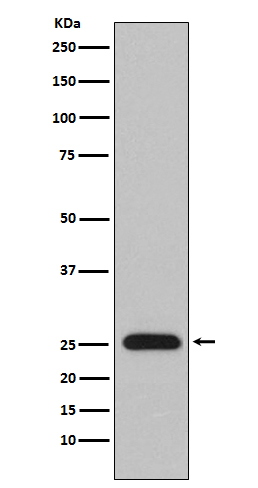 Western blot analysis of Lambda Light chain expression in human plasma lysate