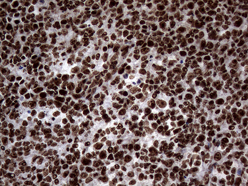 m13363 anti sh3bgrl mouse monoclonal antibody clone id oti8f7 ihc testing 10