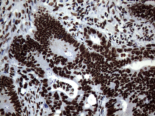 m13363 anti sh3bgrl mouse monoclonal antibody clone id oti8f7 ihc testing 11