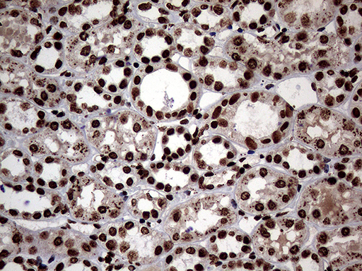 m13363 anti sh3bgrl mouse monoclonal antibody clone id oti8f7 ihc testing 12