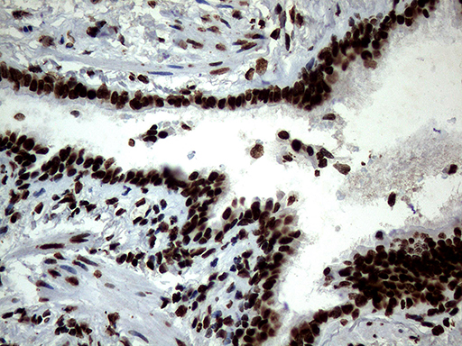 m13363 anti sh3bgrl mouse monoclonal antibody clone id oti8f7 ihc testing 14