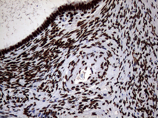 Immunohistochemical staining of paraffin-embedded Human Ovary tissue within the normal limits using anti-SH3BGRL mouse monoclonal antibody