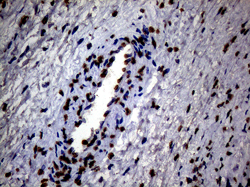 m13363 anti sh3bgrl mouse monoclonal antibody clone id oti8f7 ihc testing 4