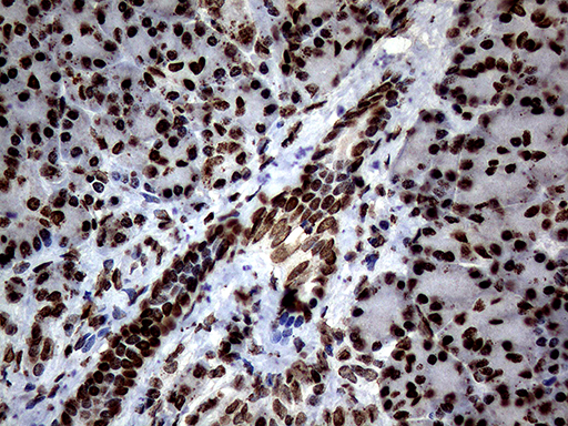 m13363 anti sh3bgrl mouse monoclonal antibody clone id oti8f7 ihc testing 5