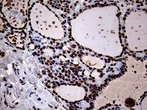 m13363 anti sh3bgrl mouse monoclonal antibody clone id oti8f7 ihc testing 6