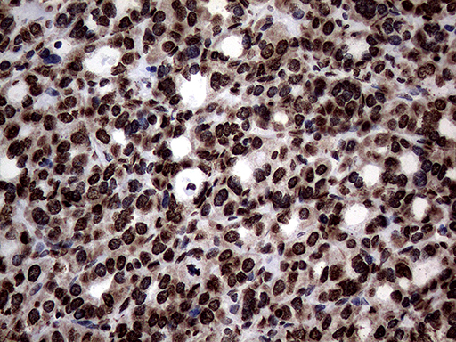 m13363 anti sh3bgrl mouse monoclonal antibody clone id oti8f7 ihc testing 7