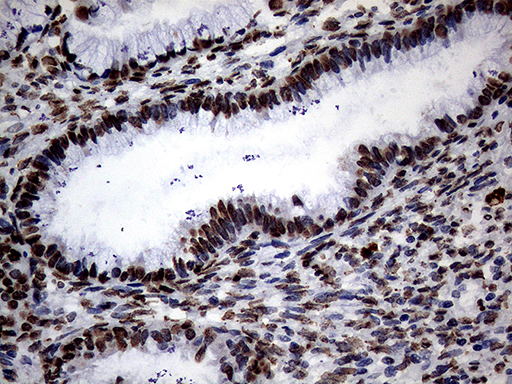 m13363 anti sh3bgrl mouse monoclonal antibody clone id oti8f7 ihc testing 9