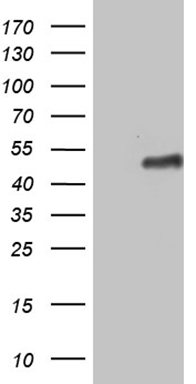 HEK293T cells were transfected with the pCMV6-ENTRY control (Left lane) or pCMV6-ENTRY ZNF330 (Right lane) cDNA for 48 hrs and lysed. Equivalent amounts of cell lysates (5 ug per lane) were separated by SDS-PAGE and immunoblotted with anti-ZNF330 (1:2000).