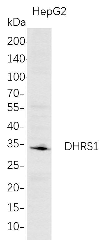 Western Blot analysis of HepG2 whole cell lysates were separated by 4-20% SDS-PAGE, and the membrane was blotted with anti-DHRS1 rabbit mAb