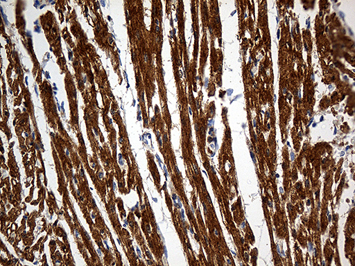 Immunohistochemical staining of paraffin-embedded Human adult heart tissue within the normal limits using anti-SH3BGR mouse monoclonal antibody
