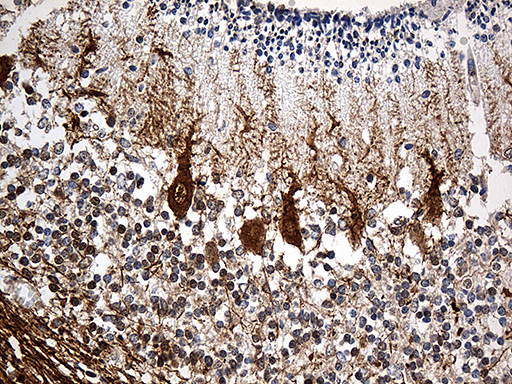 Immunohistochemical staining of paraffin-embedded Human embryonic cerebellum within the normal limits using anti-SH3BGR mouse monoclonal antibody