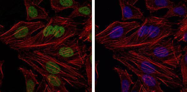 m13425 commd3 primary antibodies if testing 4