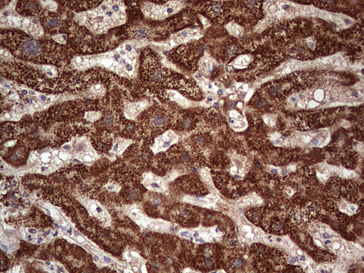 Immunohistochemical staining of paraffin-embedded Human liver tissue within the normal limits using anti-NUDT12 mouse monoclonal antibody