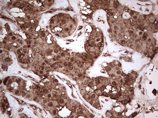m13426 anti nudt12 mouse monoclonal antibody clone id oti2g2 ihc testing 4