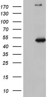 HEK293T cells were transfected with the pCMV6-ENTRY control (Left lane) or pCMV6-ENTRY NUDT12 (Right lane) cDNA for 48 hrs and lysed