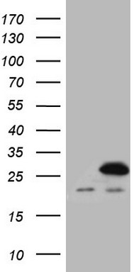 HEK293T cells were transfected with the pCMV6-ENTRY control (Left lane) or pCMV6-ENTRY SPCS2 (Right lane) cDNA for 48 hrs and lysed