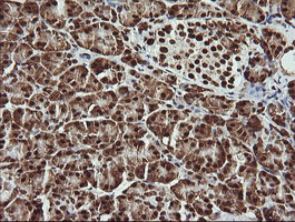 Immunohistochemical staining of paraffin-embedded Human pancreas tissue within the normal limits using anti-THUMPD1 mouse monoclonal antibody
