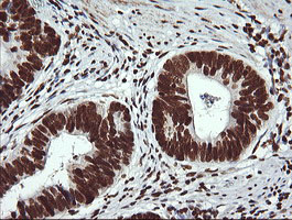 m13443 anti thumpd1 mouse monoclonal antibody clone id oti1h6 ihc testing 4