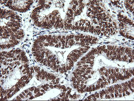 m13443 anti thumpd1 mouse monoclonal antibody clone id oti1h6 ihc testing 5