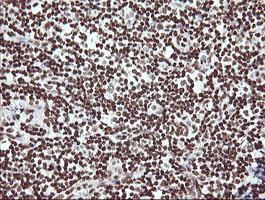 m13443 anti thumpd1 mouse monoclonal antibody clone id oti1h6 ihc testing 6