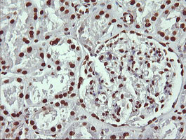 m13443 anti thumpd1 mouse monoclonal antibody clone id oti1h6 ihc testing 7