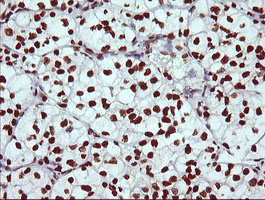 m13443 anti thumpd1 mouse monoclonal antibody clone id oti1h6 ihc testing 8