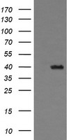 HEK293T cells were transfected with the pCMV6-ENTRY control (Left lane) or pCMV6-ENTRY THUMPD1 (Right lane) cDNA for 48 hrs and lysed