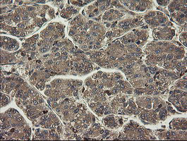 m13454 anti phf7 mouse monoclonal antibody clone id oti1g9 ihc testing 11