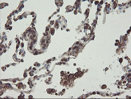 m13454 anti phf7 mouse monoclonal antibody clone id oti1g9 ihc testing 12