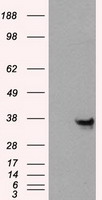 HEK293T cells were transfected with the pCMV6-ENTRY control (Left lane) or pCMV6-ENTRY ANXA10 (Right lane) cDNA for 48 hrs and lysed