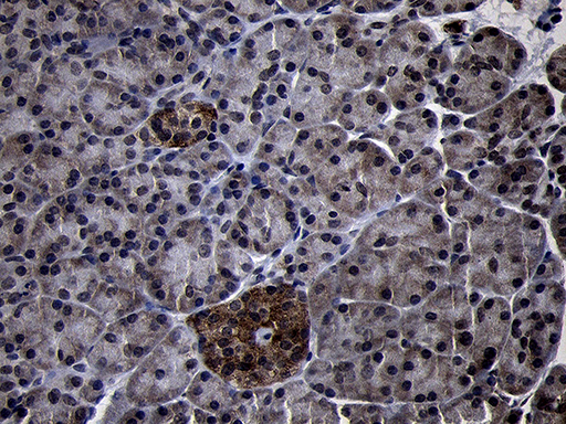 m13619 anti usp40 mouse monoclonal antibody clone id oti2c5 ihc testing 3