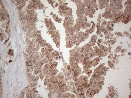 m13665 anti spata22 mouse monoclonal antibody clone id oti6h9 ihc testing 2