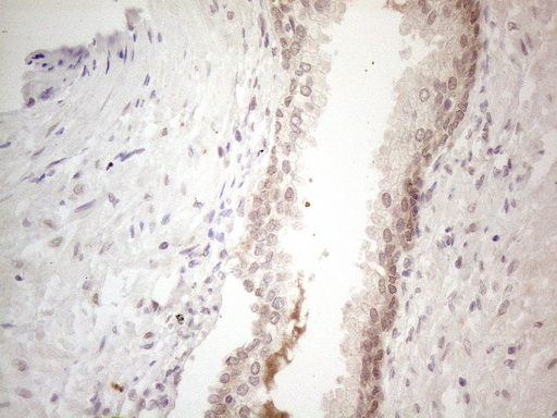 m13665 anti spata22 mouse monoclonal antibody clone id oti6h9 ihc testing 3