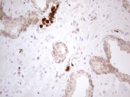 m13665 anti spata22 mouse monoclonal antibody clone id oti6h9 ihc testing 4